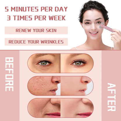 Dispositivo Rejuvenecedor Facial Tm